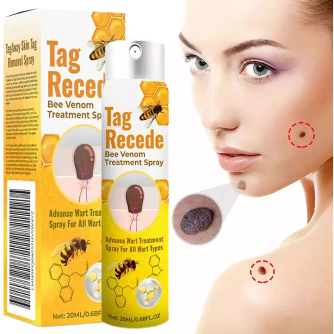 g recede eliminador de verrugas