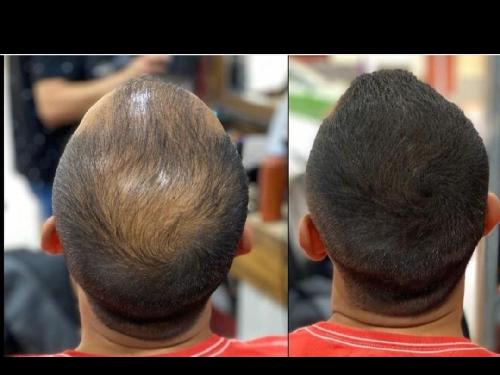 Atomizador o aplicador de fibras capilares